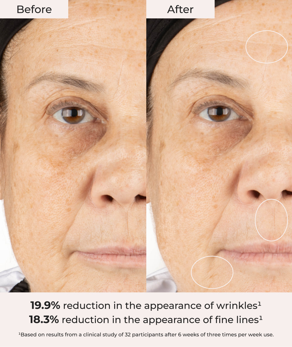 A before & after image showing a 19.9% reduction in the appearance of wrinkles & 18.3% reduction in appearance of fine lines